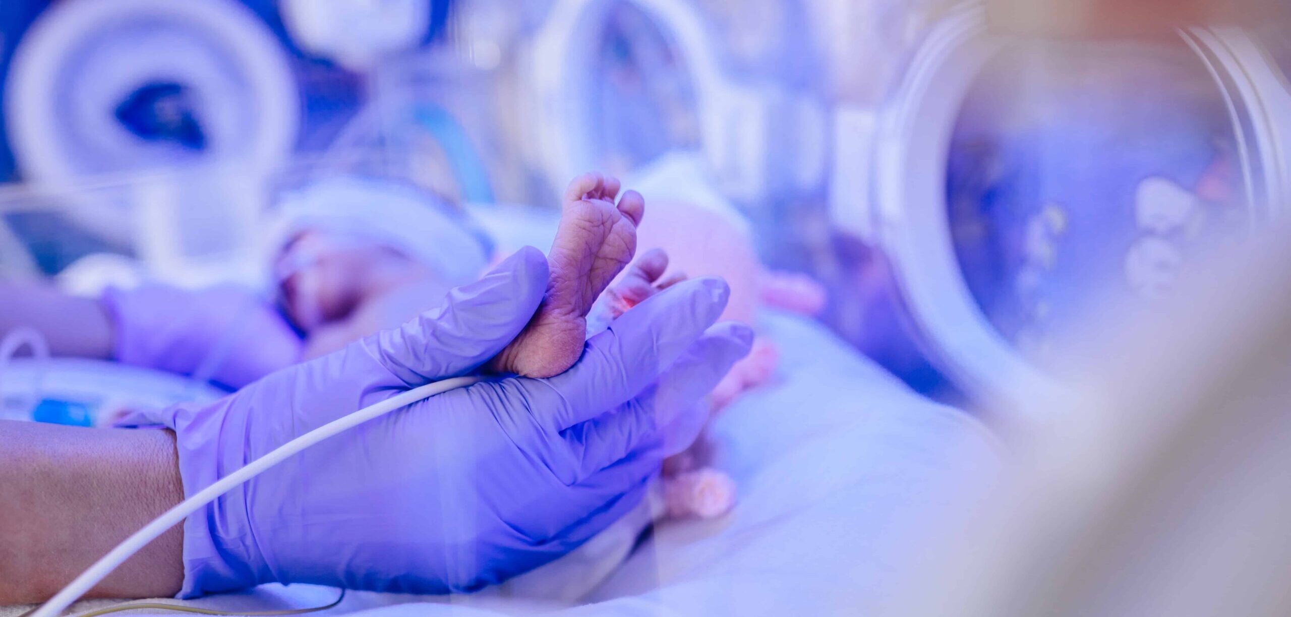 birth-injury-medical-malpractice-claims-involving-premature-birth